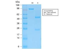 SDS-PAGE analysis of purified, BSA-free recombinant Cytokeratin 15 antibody (clone KRT15/2103R) as confirmation of integrity and purity.