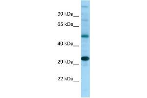 Western Blotting (WB) image for anti-NDRG Family Member 4 (NDRG4) (C-Term) antibody (ABIN2789943) (NDRG4 anticorps  (C-Term))