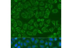 Immunofluorescence analysis of U2OS cells using ICK Polyclonal Antibody at dilution of 1:100. (ICK anticorps)