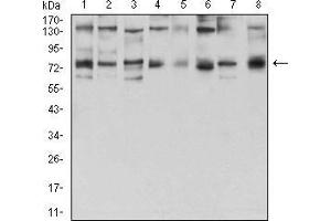 Western blot analysis using GFPT1 mouse mAb against Hela (1), HepG2 (2), HEK293 (3), BEL-7402 (4), SMMC-7721 (5), SK-MES-1 (6), C6 (7), and COS7 (8) cell lysate. (GFPT1 anticorps  (AA 536-681))
