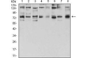 Western blot analysis using GFPT1 mouse mAb against Hela (1), HepG2 (2), HEK293 (3), BEL-7402 (4), SMMC-7721 (5), SK-MES-1 (6), C6 (7), and COS7 (8) cell lysate. (GFPT1 anticorps  (AA 536-681))