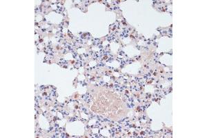 Immunohistochemistry of paraffin-embedded mouse lung using Lysozyme (Lysozyme (LYZ)) antibody (ABIN6133802, ABIN6143409, ABIN6143412 and ABIN6217538) at dilution of 1:100 (40x lens). (LYZ anticorps  (AA 1-100))