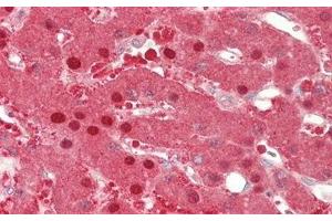 Detection of ALT in Human Liver Tissue using Polyclonal Antibody to Alanine Aminotransferase (ALT)