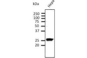 Anti-Rab11 Ab  at 1/500 dilution;  Hepa cell line at 100 µg per lane; rabbit polyclonal to goat lgG (HRP) at 1/10. (RAB11A anticorps  (C-Term))