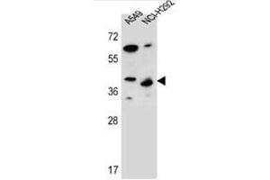 Western blot analysis of LRRC67 Antibody (C-term) in A549,NCI-H292 cell line lysates (35ug/lane).