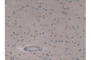 IHC-P analysis of Human Brain Tissue, with DAB staining. (ABCC8 anticorps  (AA 679-929))