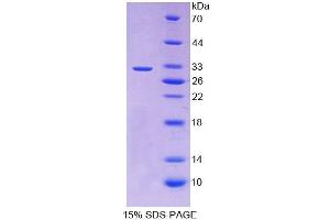 SDS-PAGE analysis of Human RARb Protein. (Retinoic Acid Receptor beta Protéine)