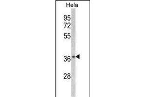 Western blot analysis of NFKBIA-S32/36 (ABIN652417 and ABIN2842077) in Hela cell line lysates (35 μg/lane). (NFKBIA anticorps  (AA 12-41))