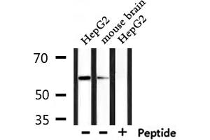 Western blot analysis of extracts from mouse brain and HepG2, using Caspase 10 Antibody. (Caspase 10 anticorps)