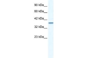 WB Suggested Anti-MTA1 Antibody Titration:  2. (MTA1 anticorps  (C-Term))