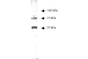 Figure 1. (ADH1 anticorps)