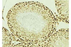 ABIN6276851 at 1/100 staining Mouse testis tissue by IHC-P. (LIG4 anticorps  (C-Term))