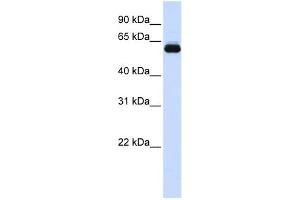 WB Suggested Anti-TRIM60 Antibody Titration:  0.