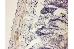 IHC-P testing of rat intestine tissue