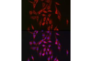 Immunofluorescence analysis of NIH/3T3 cells using PRK Rabbit pAb (ABIN6129908, ABIN6146179, ABIN6146181 and ABIN6222702) at dilution of 1:150 (40x lens). (PRKAB2 anticorps  (AA 1-272))
