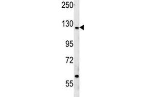 CUX1 antibody western blot analysis in MCF-7 lysate