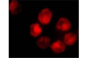 Immunofluorescence staining of K562 cells using AP30017PU-N ADAM10 antibody at 10 μg/ml.