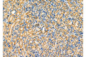 ABIN6263586 and ABIN6276332 at 1/100 staining Mouse kidney tissue by IHC-P. (NEFL anticorps  (N-Term))