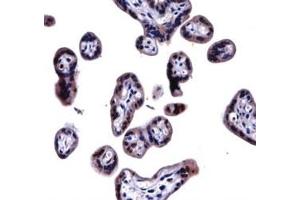 SOCS6 antibody immunohistochemistry analysis in formalin fixed and paraffin embedded human placenta tissue.