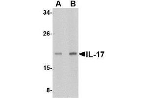 Western blot analysis of IL-17 in A-20 lysate with AP30409PU-N IL-17 antibody at (A) 2 and (B) 4 μg/ml. (Interleukin 17a anticorps  (N-Term))