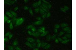 Detection of CBG in Human Hela Cells using Polyclonal Antibody to Corticosteroid Binding Globulin (CBG)