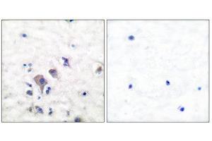 Immunohistochemistry (IHC) image for anti-Glutamate Receptor, Ionotropic, AMPA 2/3 (GRIA2/3) (C-Term) antibody (ABIN1848570) (mGluR2/3 anticorps  (C-Term))