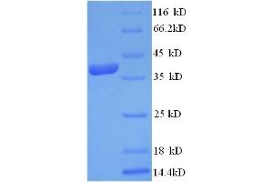 SDS-PAGE (SDS) image for C-Fos Induced Growth Factor (Vascular Endothelial Growth Factor D) (Figf) (AA 89-205) protein (GST tag) (ABIN5712536) (VEGFD Protein (AA 89-205) (GST tag))