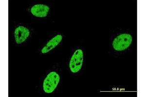 Immunofluorescence of monoclonal antibody to NOTCH3 on HeLa cell.