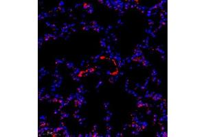 Immunofluorescence of paraffin embedded mouse pneumonia using TBCldl (ABIN7075843) at dilution of 1:1000 (300x lens)