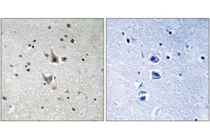 Immunohistochemistry analysis of paraffin-embedded human brain, using PSEN1 (Phospho-Ser357) Antibody. (Presenilin 1 anticorps  (pSer357))