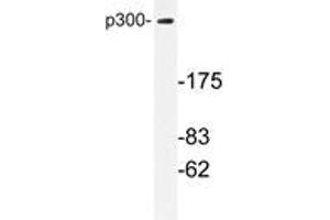 Western blot analysis with EP300 / P300 antibody in extracts from MDA-MB-435 cells. (p300 anticorps)