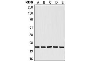 Western blot analysis of RALB expression in HepG2 (A), Jurkat (B), A549 (C), NIH3T3 (D), PC12 (E) whole cell lysates. (RALB anticorps  (Center))
