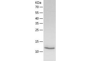 Western Blotting (WB) image for NME/NM23 Nucleoside Diphosphate Kinase 3 (NME3) (AA 22-169) protein (His-IF2DI Tag) (ABIN7124185)