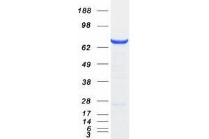 Validation with Western Blot