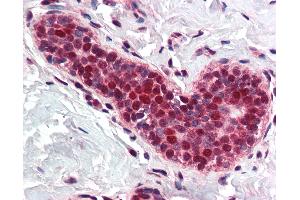 Anti-PCNA antibody IHC of human breast. (PCNA anticorps  (Internal Region))