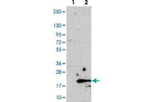 Western blot analysis of Lane 1: Negative control (vector only transfected HEK293T lysate). (C19orf48 anticorps)