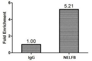Chromatin Immunoprecipitation Hela (1.