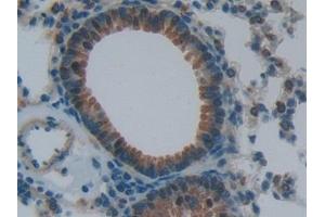 Detection of NPPB in Mouse Lung Tissue using Polyclonal Antibody to Natriuretic Peptide Precursor B (NPPB)