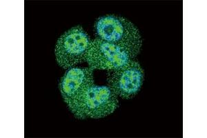 Confocal immunofluorescent analysis of AKT antibody with MCF-7 cells followed by Alexa Fluor 488-conjugated goat anti-rabbit lgG (green).