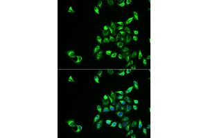 Immunofluorescence analysis of HeLa cells using CSNK1A1L antibody (ABIN5973884). (CSNK1A1L anticorps)