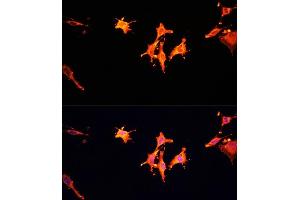 Immunofluorescence analysis of C6 cells using MSP/MST1 antibody (ABIN6132374, ABIN6144095, ABIN6144096 and ABIN6216790) at dilution of 1:100.