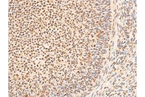 ABIN6267301 at 1/100 staining rat ovarian tissue sections by IHC-P.