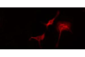 ABIN6274767 staining Hela cells by IF/ICC. (RPL11 anticorps  (C-Term))