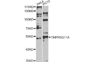 Western blot analysis of extracts of various cell lines, using TMPRSS11A antibody. (TMPRSS11A anticorps)