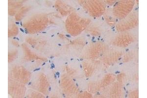 Detection of PDK4 in Mouse Skeletal muscle Tissue using Polyclonal Antibody to Pyruvate Dehydrogenase Kinase 4 (PDK4)