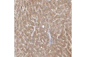 Immunohistochemical staining of human liver with MICAL2 polyclonal antibody  shows moderate cytoplasmic and membranous positivity in hepatocytes. (MICAL2 anticorps)