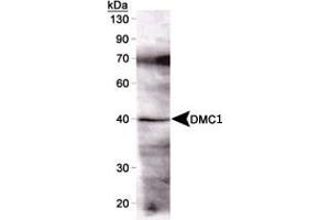 Western blot detection of DMC1 (37 kDa) from mouse testis using DMC1 monoclonal antibody, clone 1D12/4  (1 : 1000). (DMC1 anticorps)