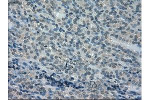 Immunohistochemistry (IHC) image for anti-Dihydrofolate Reductase (DHFR) antibody (ABIN1497822)
