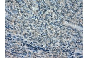 Immunohistochemistry (IHC) image for anti-Dihydrofolate Reductase (DHFR) antibody (ABIN1497822) (Dihydrofolate Reductase anticorps)