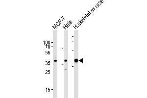 Western blot analysis of lysates from MCF-7, Hela cell line and human skeletal muscle tissue lysate (from left to right), using ALDOA Antibody at 1:1000 at each lane.